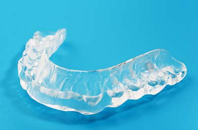 Image of a bite splint 