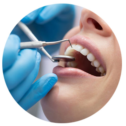 Preventative Teeth Cleaning